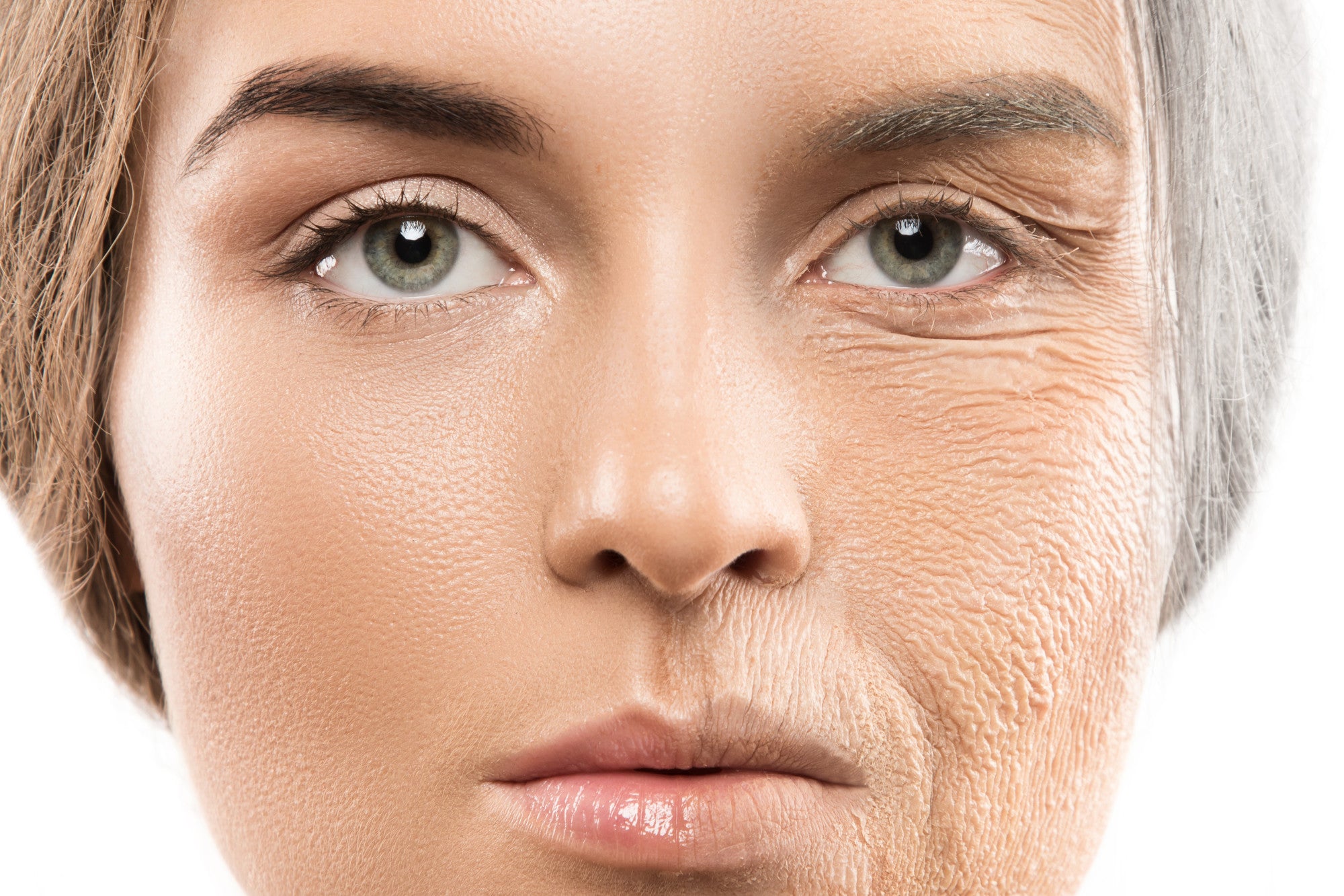Fine Lines and Wrinkles: What's the Difference and How to Treat
