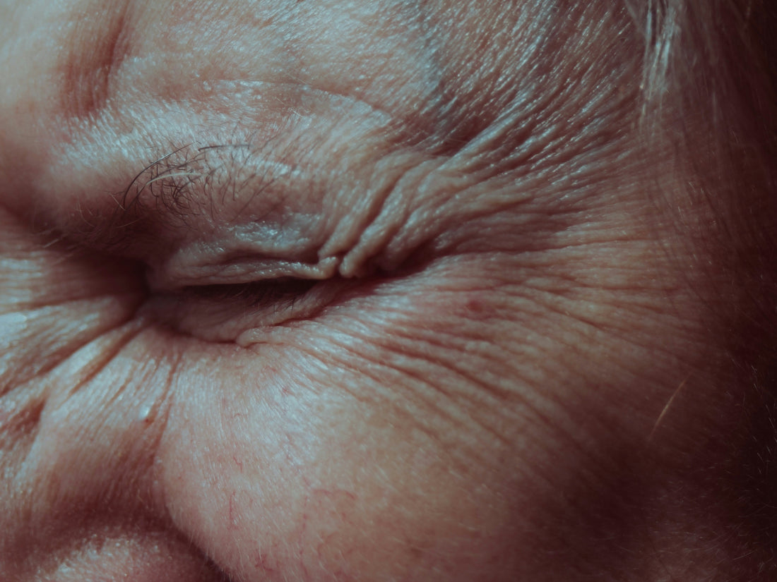 How Microneedling Fights Wrinkle