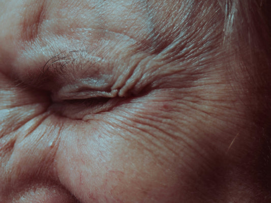 How Microneedling Fights Wrinkle