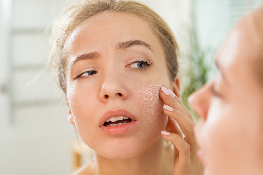 The 3 Most Common Causes Of Dry Skin