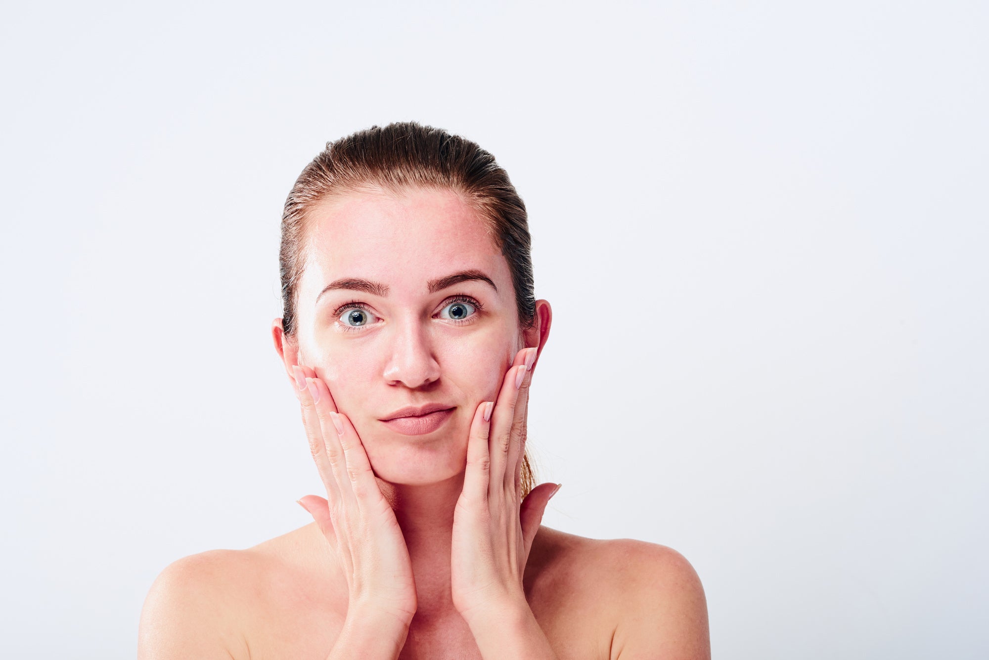 How to Treat Rosacea Naturally
