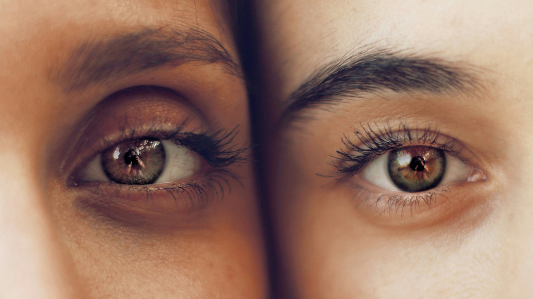 How to Brighten Dark Under-Eye Bags