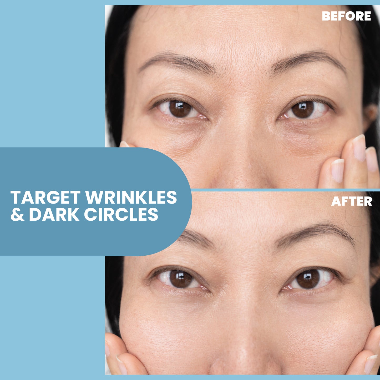 Anti-Aging Eye Gel - 2 oz