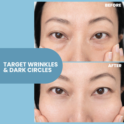 Anti-Aging Eye Gel - 2 oz