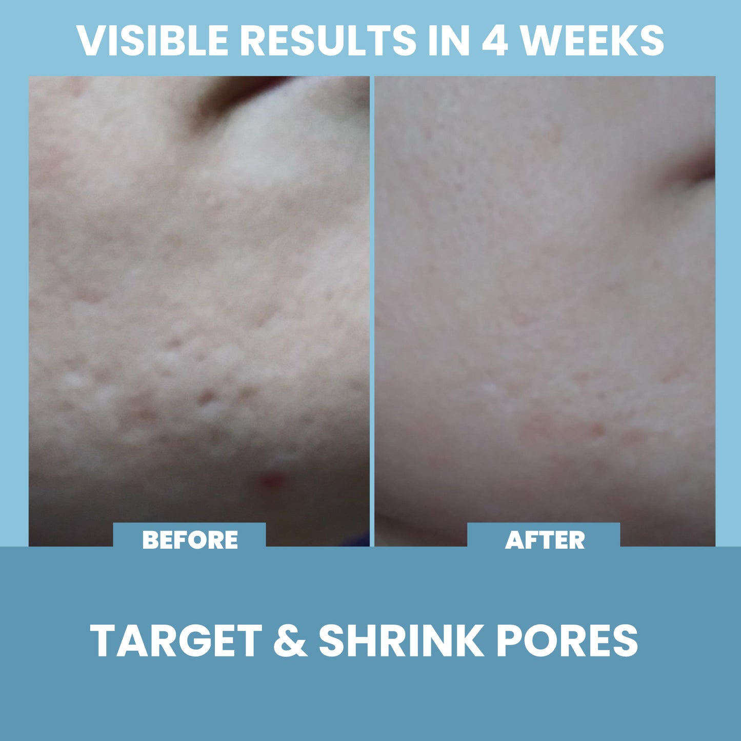 Niacinamide Vitamin B3 Serum - 2 oz