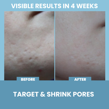 Niacinamide Vitamin B3 Serum - 2 oz