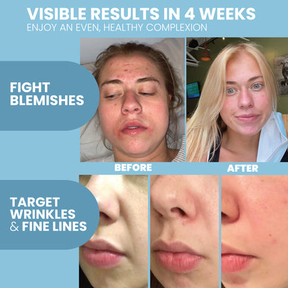 Retinol Anti Wrinkle Serum - 2 oz