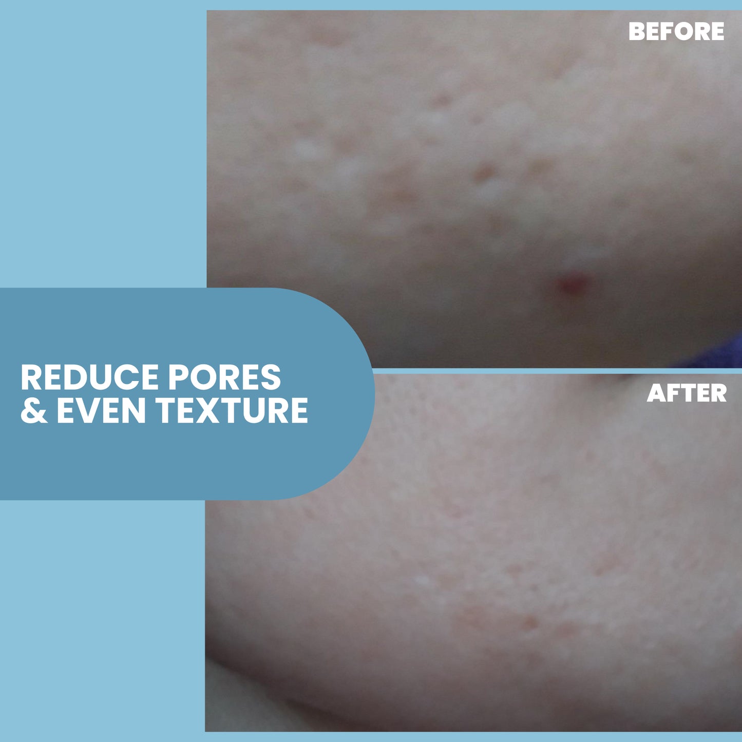 Skin Firming & Tightening Serum - 1 oz