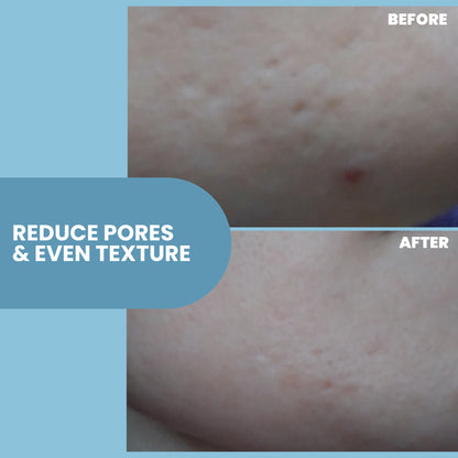 Skin Firming & Tightening Serum - 1 oz