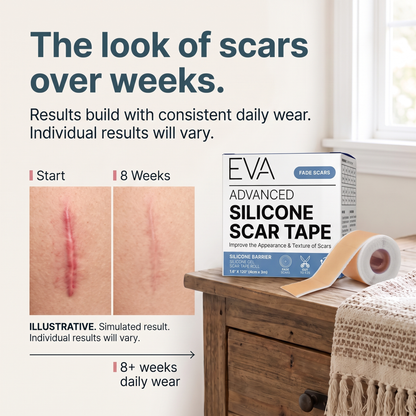 Scar Tape